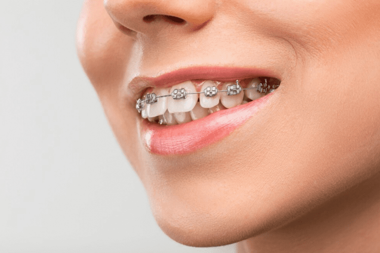 ortodoncia en getafe