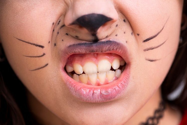 Dentistas en Getafe (Madrid) Dental Studio Getafe sangrado de encias