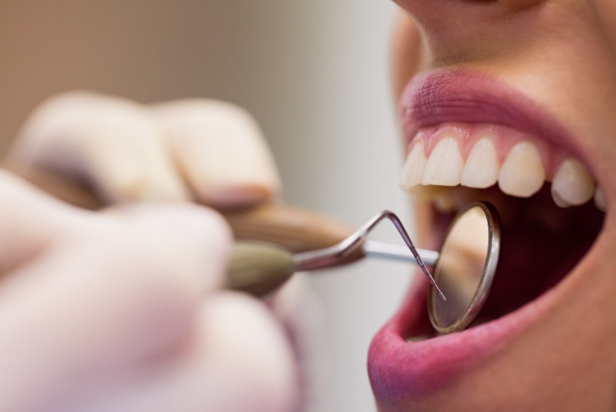Reconstrucción dental
